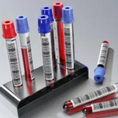 Diagnostic Test Kits